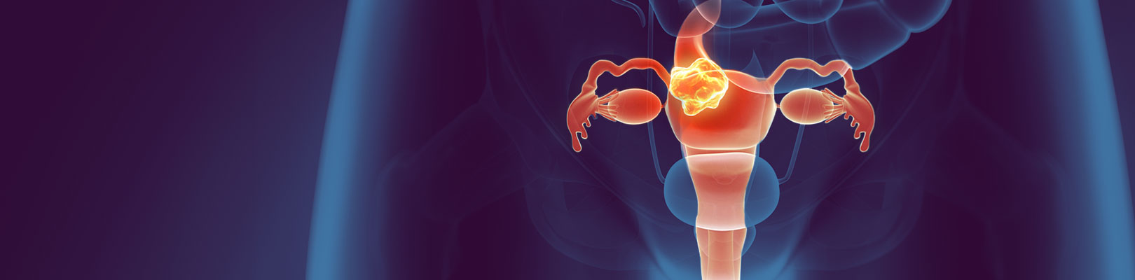 Bannerinterno 1620x400px%20 4