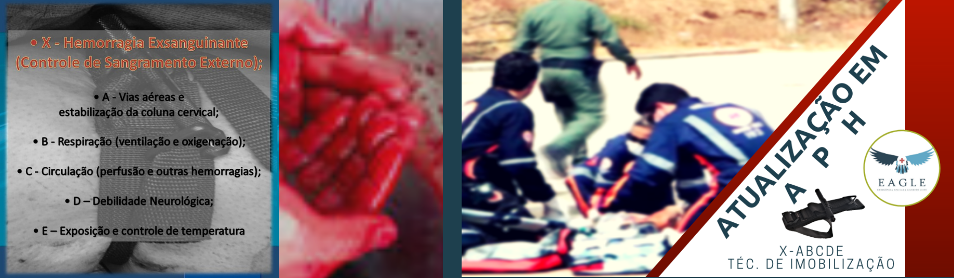 Banner%20aph%20xabcde