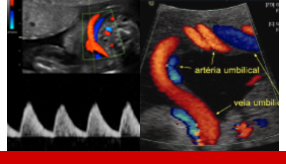 Cursos presenciais e on line doppler obstetrico v01